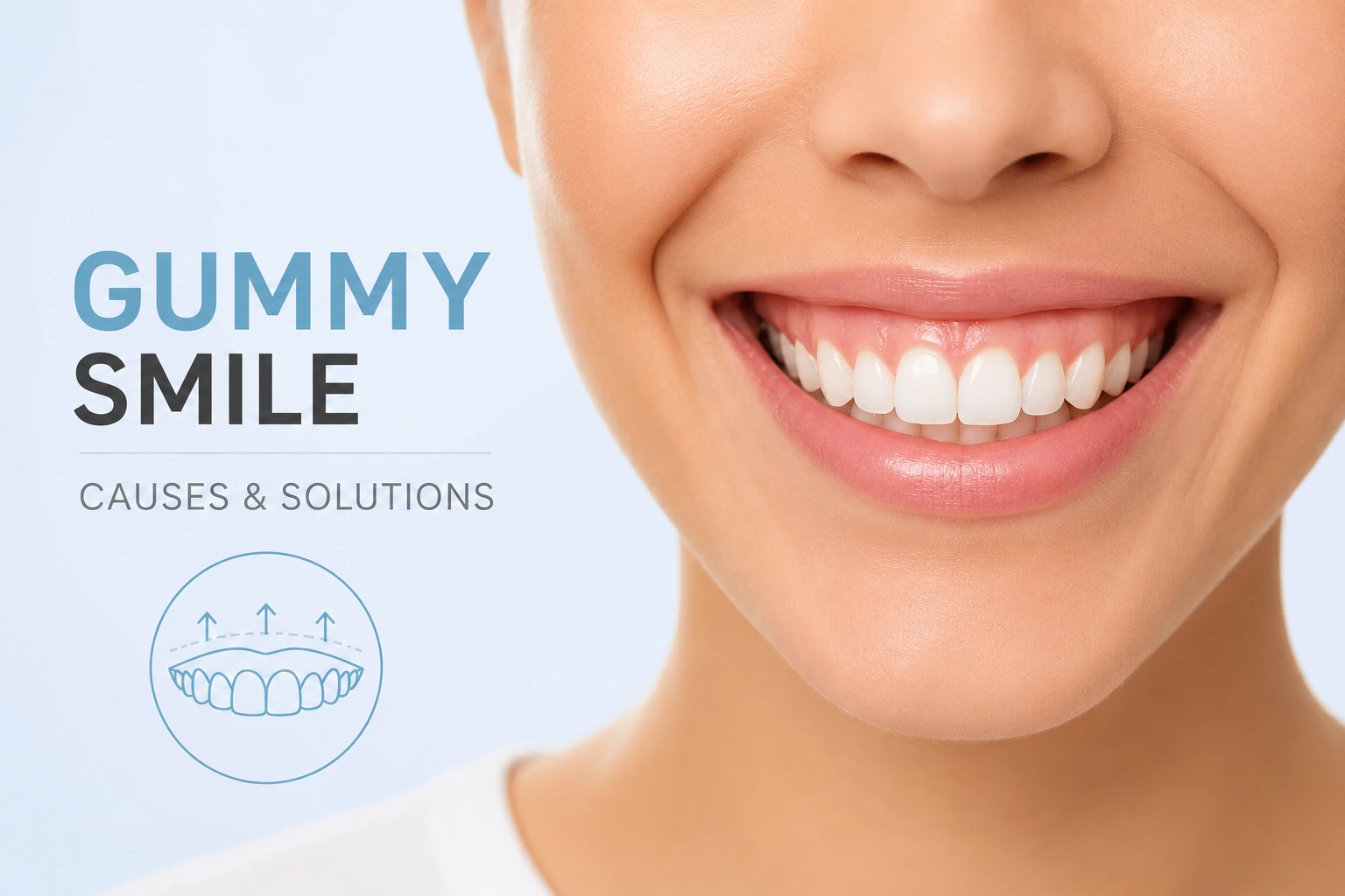 Gummy Smile: What Causes It and How to Fix It